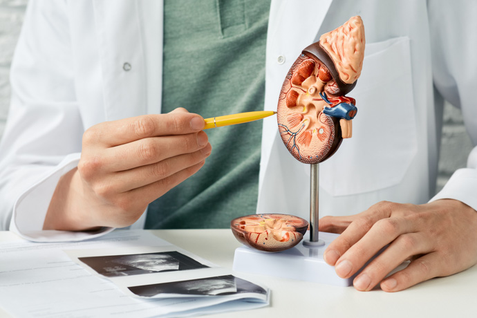 Médico mostrando los efectos de una dieta baja en sodio en el riñón.